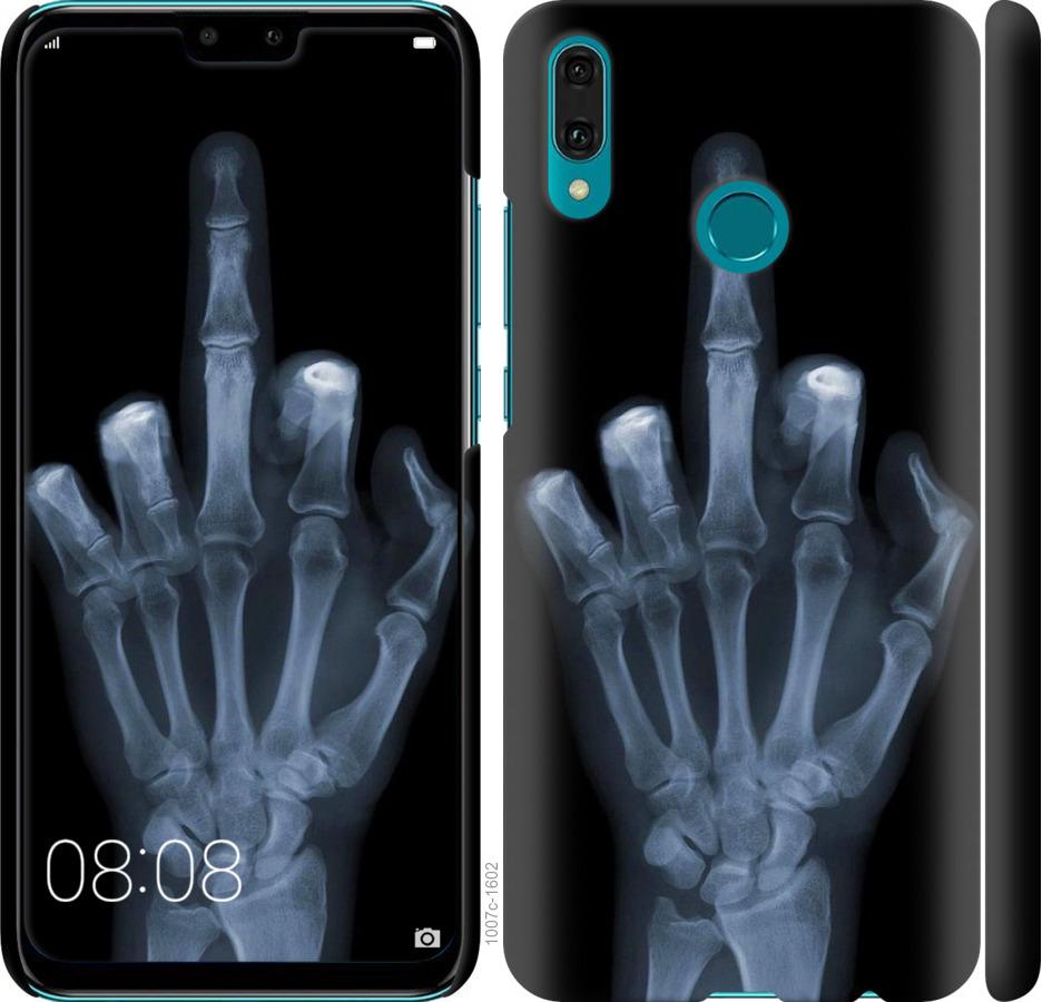Чехол на Huawei Y9 2019 Рука через рентген