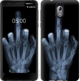 Чехол на Nokia 3.1 Рука через рентген