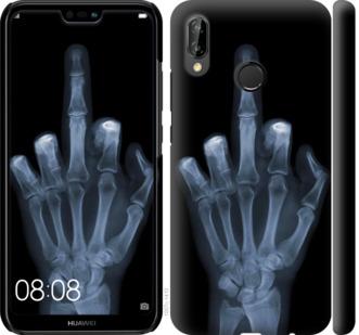 Чехол на Huawei P20 Lite Рука через рентген