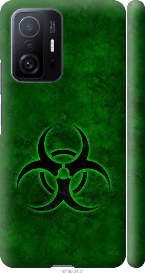 Чехол на Xiaomi 11T biohazard 30