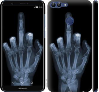 Чехол на Huawei P Smart Рука через рентген