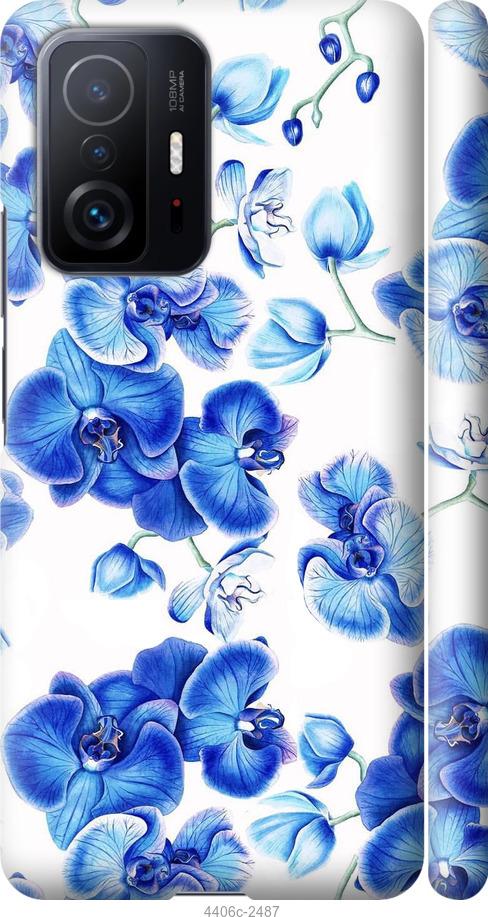 Чехол на Xiaomi 11T Голубые орхидеи