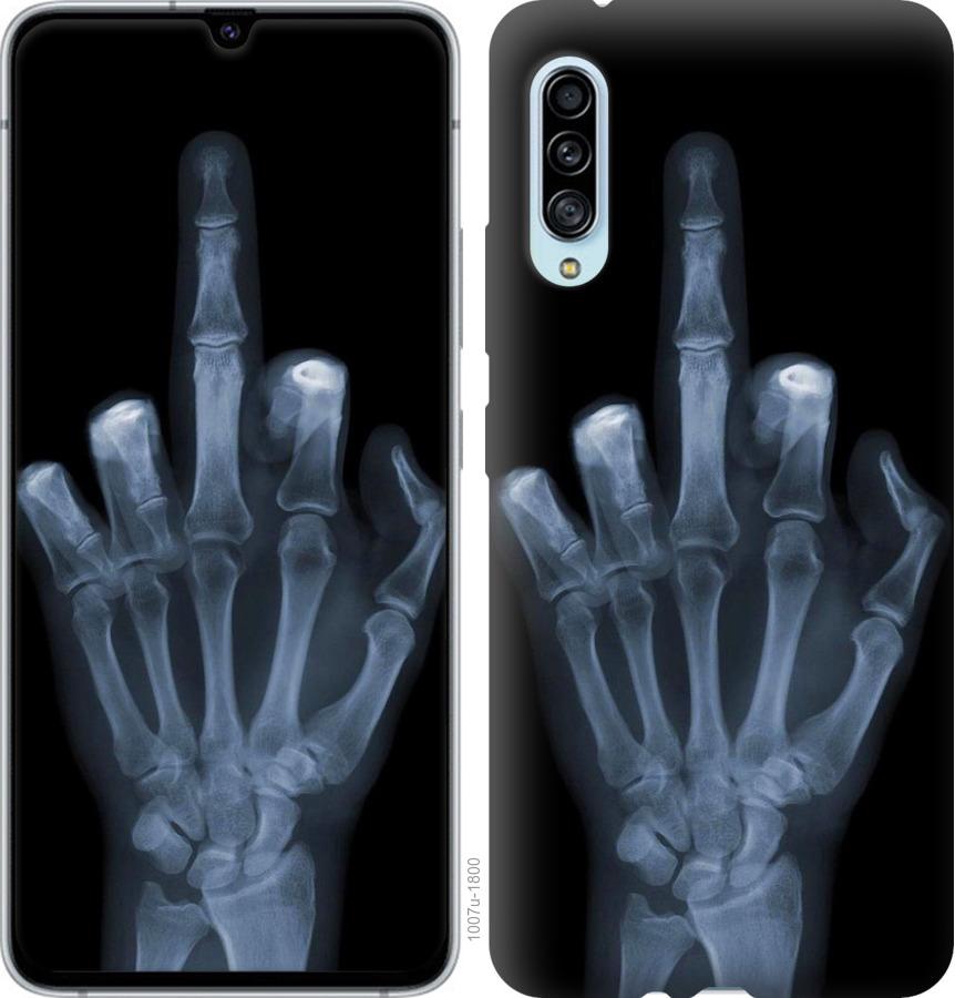 Чехол на Samsung Galaxy A90 5G Рука через рентген