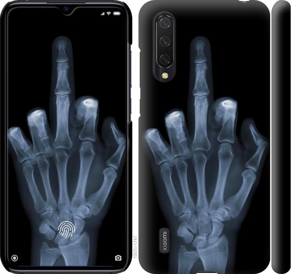 Чехол на Xiaomi Mi 9 Lite Рука через рентген
