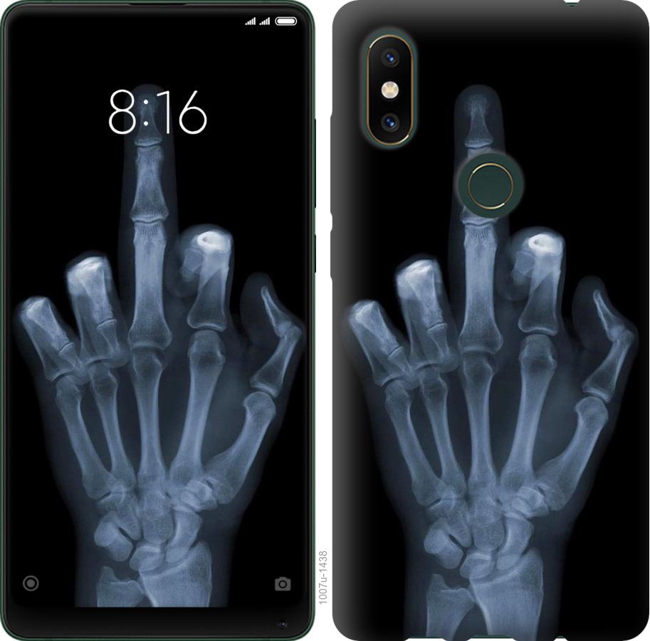 Чехол на Xiaomi Mi Mix 2s Рука через рентген