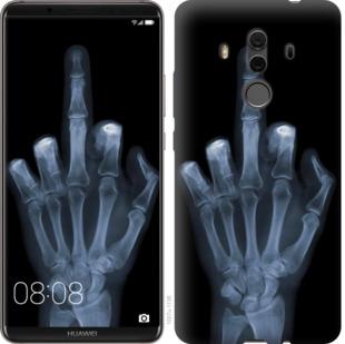 Чехол на Huawei Mate 10 Pro Рука через рентген