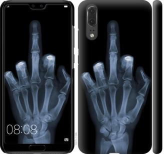 Чехол на Huawei P20 Рука через рентген