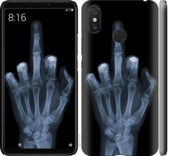 Чехол на Xiaomi Mi Max 3 Рука через рентген