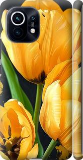 Чехол на Xiaomi Mi 11 Желтые тюльпаны