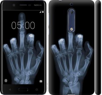 Чехол на Nokia 5 Рука через рентген