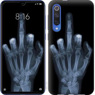 Чехол на Xiaomi Mi 9 SE Рука через рентген