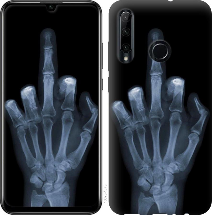 Чехол на Huawei Honor 20 Lite Рука через рентген