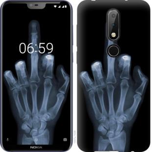 Чехол на Nokia 6.1 Plus Рука через рентген