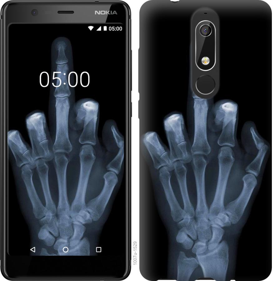 Чехол на Nokia 5.1 Рука через рентген
