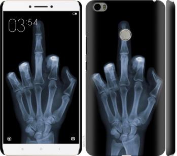 Чехол на Xiaomi Mi Max Рука через рентген