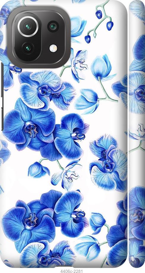 Чехол на Xiaomi Mi 11 Lite Голубые орхидеи