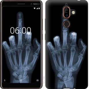 Чехол на Nokia 7 Plus Рука через рентген