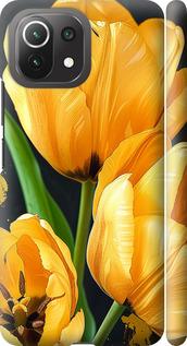 Чехол на Xiaomi Mi 11 Lite Желтые тюльпаны