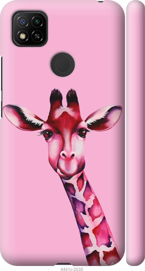 Чехол на Xiaomi Redmi 9C Розовая жирафа