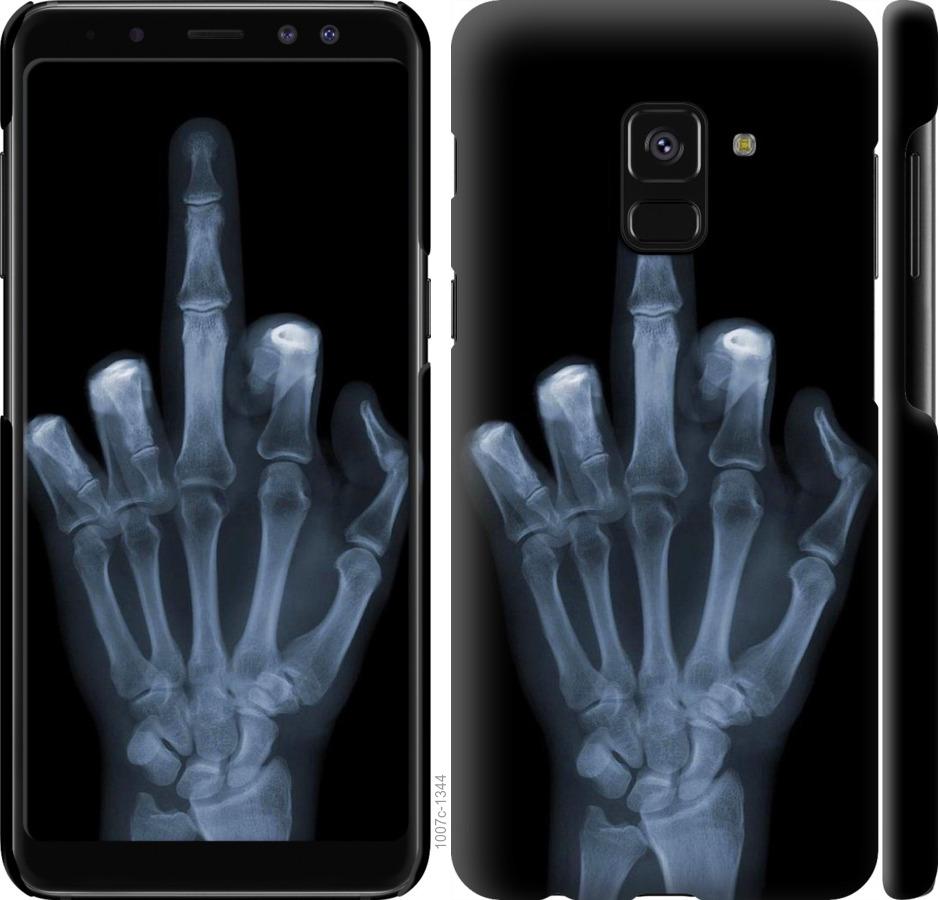 Чехол на Samsung Galaxy A8 2018 A530F Рука через рентген