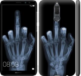 Чехол на Huawei Mate 10 Lite Рука через рентген