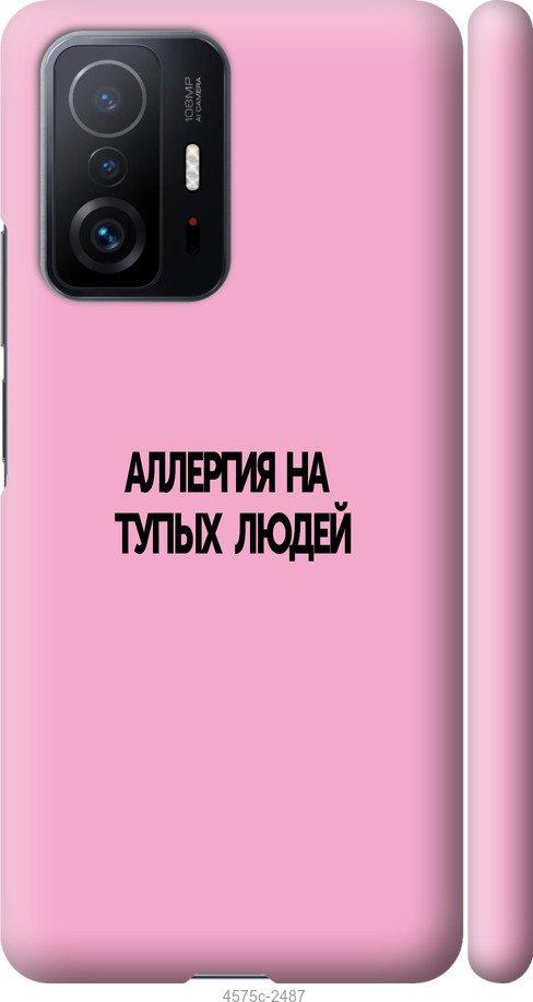 Чехол на Xiaomi 11T Аллергия