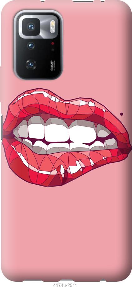 Чехол на Xiaomi Poco X3 GT Sexy lips