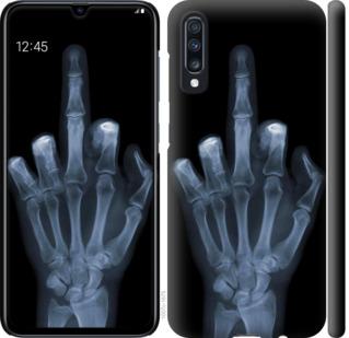 Чехол на Samsung Galaxy A70 2019 A705F Рука через рентген