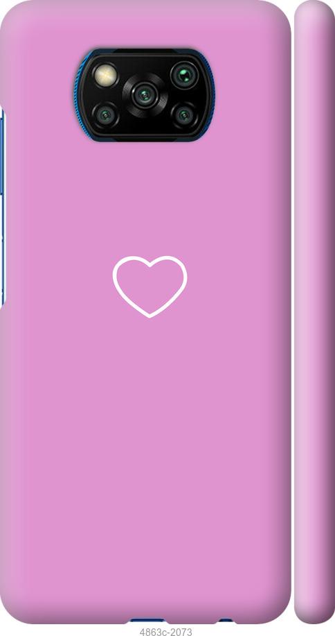 Чехол на Xiaomi Poco X3 Сердце 2