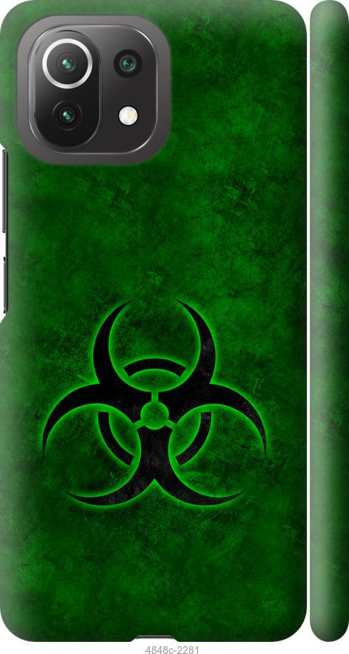 Чехол на Xiaomi Mi 11 Lite biohazard 30