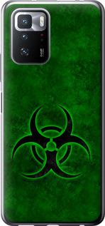 Чехол на Xiaomi Redmi Note 10 Pro 5G biohazard 30