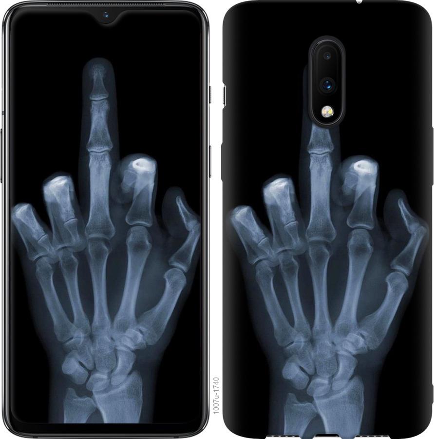 Чехол на OnePlus 7 Рука через рентген
