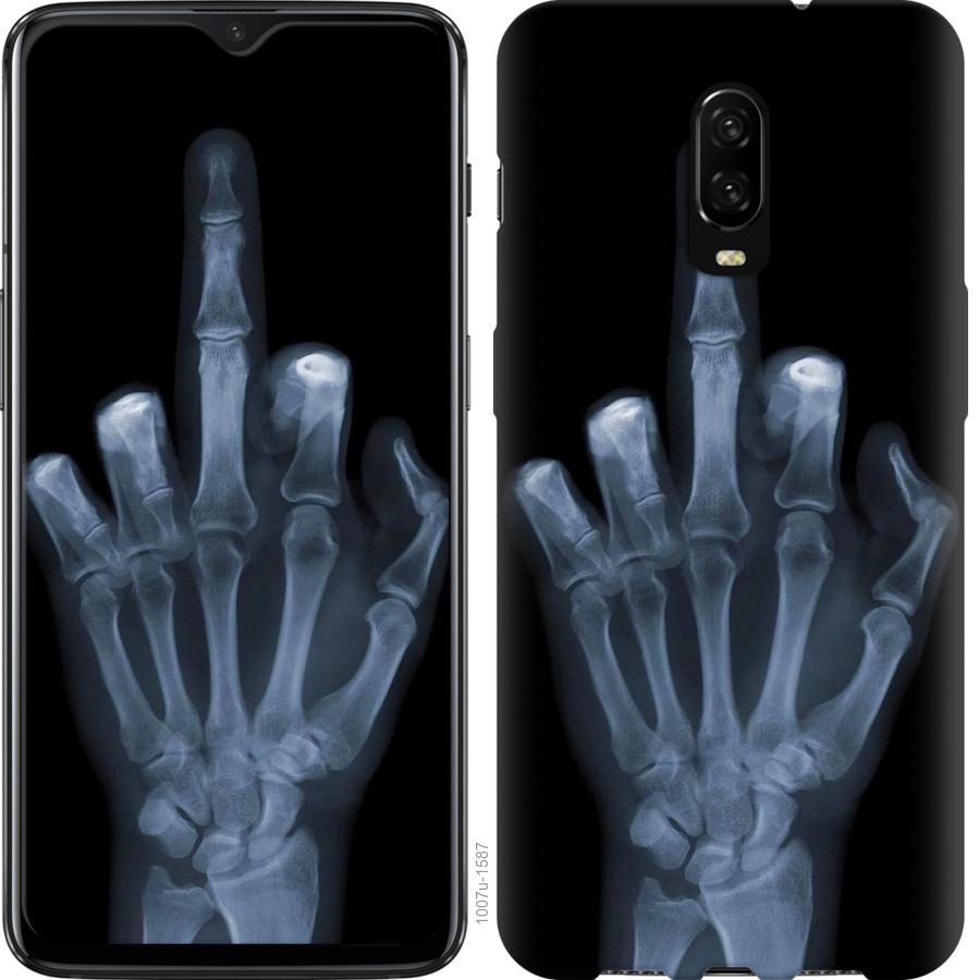 Чехол на OnePlus 6T Рука через рентген