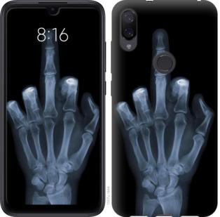Чехол на Xiaomi Mi Play Рука через рентген