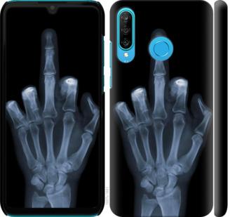 Чехол на Huawei P30 Lite Рука через рентген