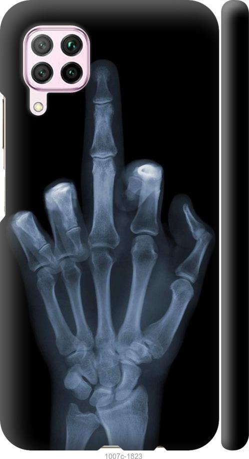 Чехол на Huawei P40 Lite Рука через рентген