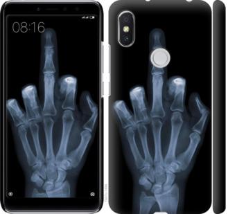 Чехол на Xiaomi Redmi S2 Рука через рентген
