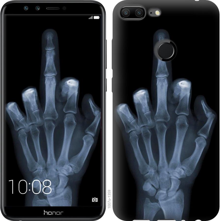 Чехол на Huawei Honor 9i Рука через рентген