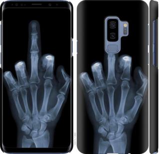 Чехол на Samsung Galaxy S9 Plus Рука через рентген