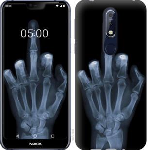 Чехол на Nokia 7.1 Рука через рентген