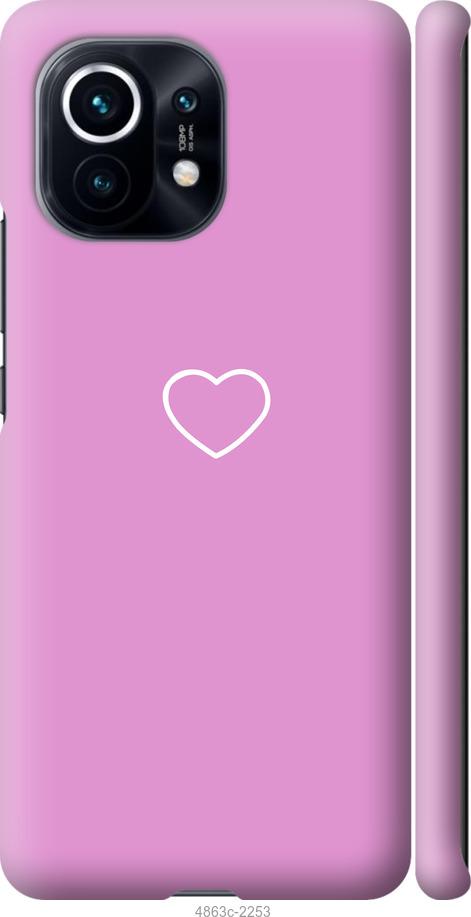 Чехол на Xiaomi Mi 11 Сердце 2