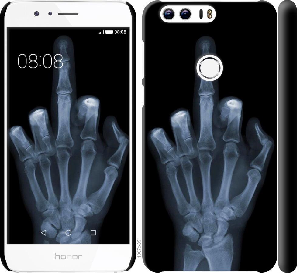 Чехол на Huawei Honor 8 Рука через рентген
