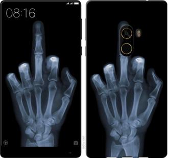 Чехол на Xiaomi Mi MiX 2 Рука через рентген