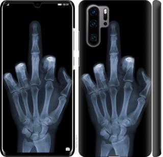 Чехол на Huawei P30 Pro Рука через рентген