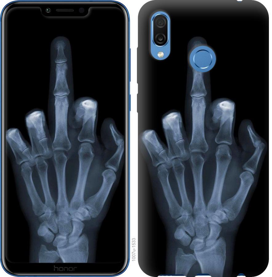 Чехол на Huawei Honor Play Рука через рентген