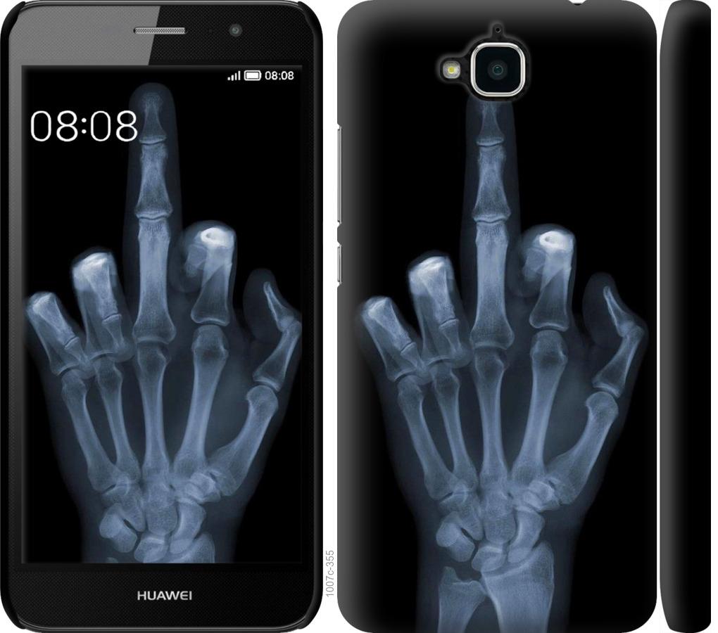 Чехол на Huawei Y6 Pro Рука через рентген