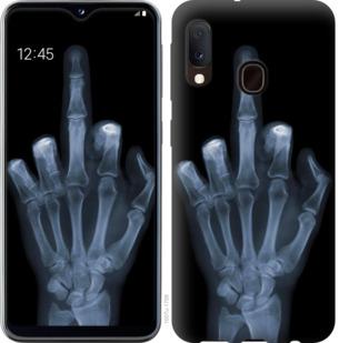 Чехол на Samsung Galaxy A20e A202F Рука через рентген