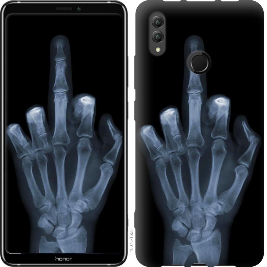 Чехол на Huawei Honor Note 10 Рука через рентген